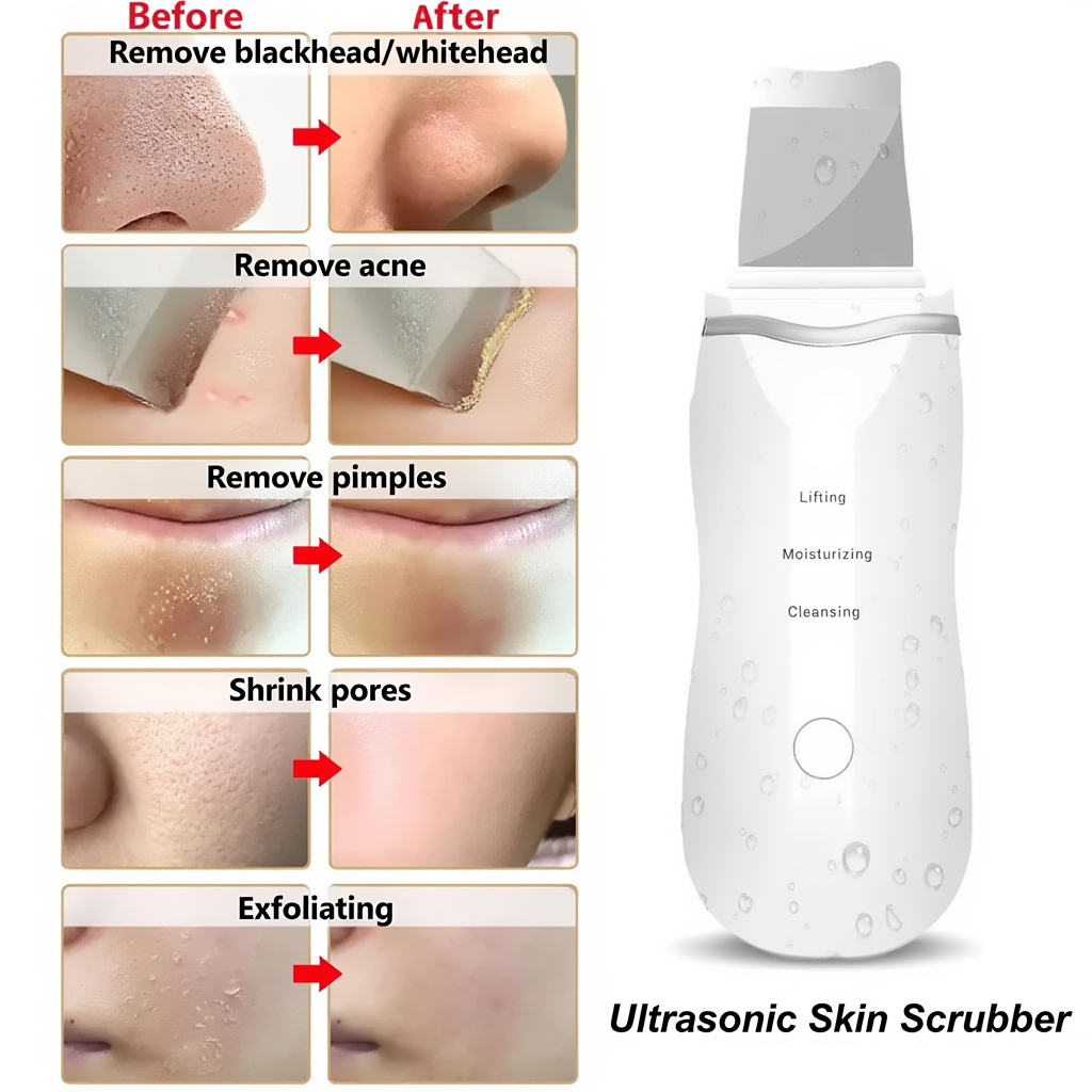Ultrasonic Face Spatula Pore Cleaner Peeling Tool