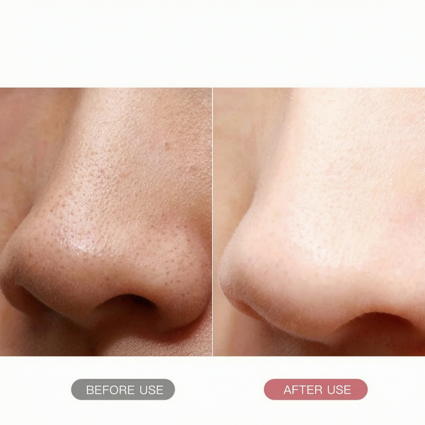 RF EMS Face Massager Anti-Wrinkle Beauty Device