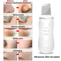 Ultrasonic Face Spatula Pore Cleaner Peeling Tool